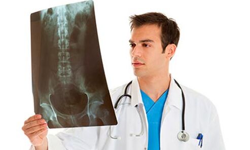 The doctor examines an x-ray to determine back pain